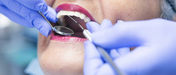 Best Emergency Root Canal Treatment in Nice, CA