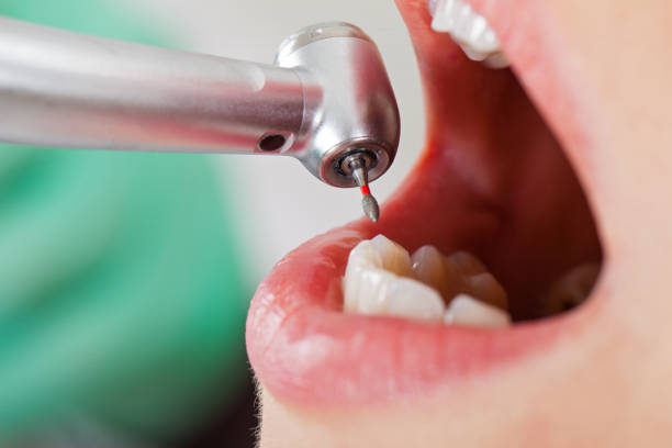 Best Pediatric Emergency Dentist in Nice, CA